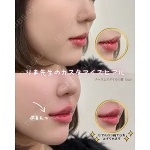 HAAB BEAUTY CLINIC 南青山本院（新院） 蟹谷 莉麻医師の症例
