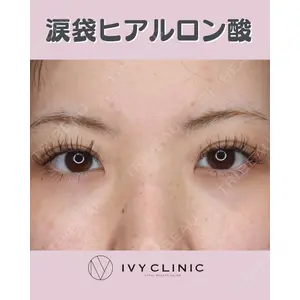 千葉美容外科アイビークリニックの症例