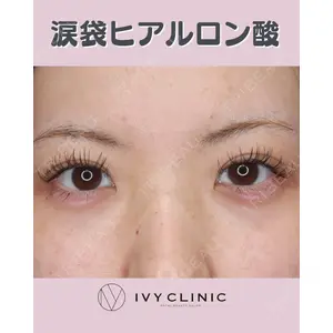 千葉美容外科アイビークリニックの症例