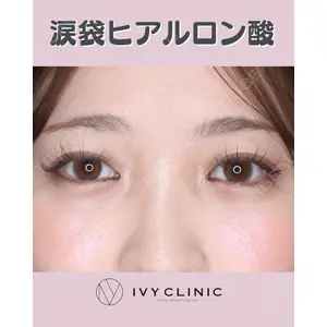 千葉美容外科アイビークリニックの症例