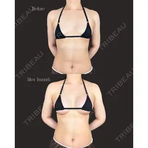 IANA CLINIC 穴井 元康医師の症例