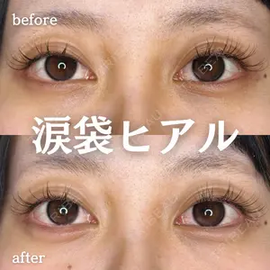 ルラ美容クリニック 新宿院 陶 美梨医師の症例