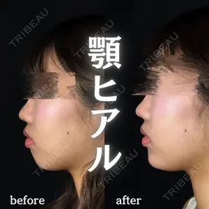 ルラ美容クリニック 新宿院 陶 美梨医師の症例