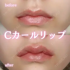 ルラ美容クリニック 新宿院 陶 美梨医師の症例