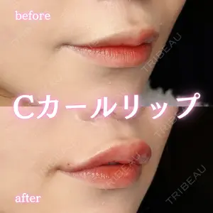 ルラ美容クリニック 新宿院 陶 美梨医師の症例