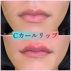 ルラ美容クリニック 新宿院 金田 成美医師の症例