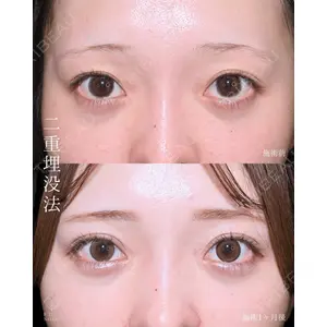 藤・ナチュレ美容クリニック 銀座院 小川 杏平医師の症例