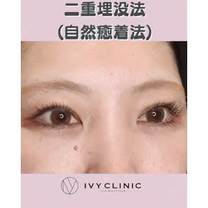 千葉美容外科アイビークリニックの症例