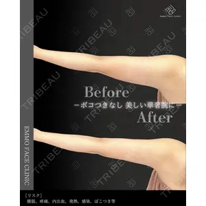 EMMO FACE CLINIC 大阪梅田院 松本洋麻医師の症例