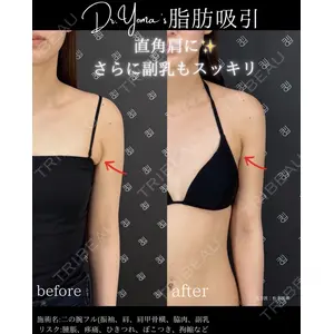 EMMO FACE CLINIC 大阪梅田院 松本洋麻医師の症例