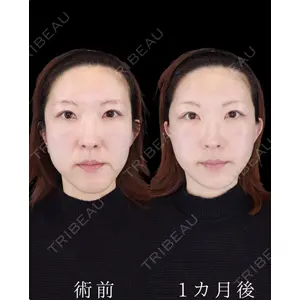 HAAB BEAUTY CLINIC 南青山本院（新院） 小平 佳典医師の症例