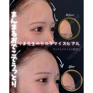 HAAB BEAUTY CLINIC 南青山本院（新院） 蟹谷 莉麻医師の症例