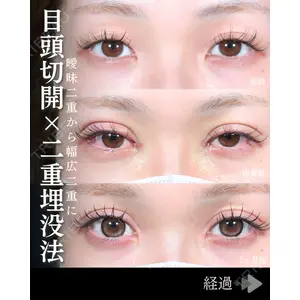 東京シンデレラ美容外科 池袋院 石井 達也医師の症例