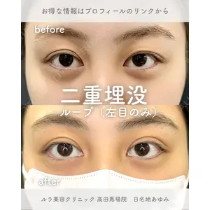 ルラ美容クリニック 高田馬場院 日名地 あゆみ医師の症例