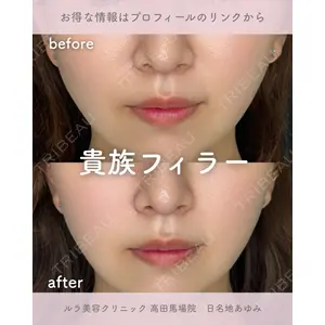 ルラ美容クリニック 高田馬場院 日名地 あゆみ医師の症例