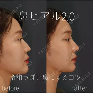 BIANCA銀座 池田 雪太郎医師の症例