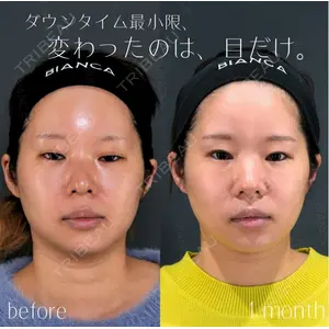 BIANCA銀座 池田 雪太郎医師の症例