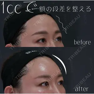 BIANCA銀座 池田 雪太郎医師の症例