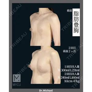 MYCLI【マイクリ】東京・恵比寿院 本田マイケル武史医師の症例