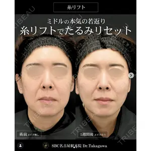 湘南美容クリニック 名古屋駅本院 高川 裕也医師の症例