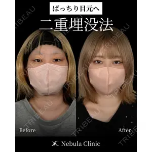 愛知春日井美容外科ネビュラクリニック 都築 諒医師の症例