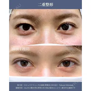 ネビュラクリニック 広島院 白岩 拓巳医師の症例