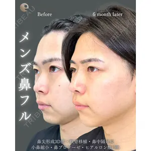 eクリニック 福岡院 伊藤 渉医師の症例