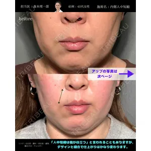 PRISM Beauty Clinic 町田院の症例
