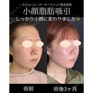 ルラ美容クリニック 仙台院 / ルラスキンクリニック 仙台院 橋本 英樹医師の症例