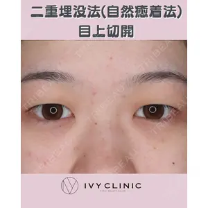 千葉美容外科アイビークリニックの症例