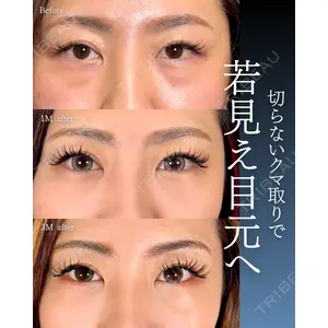神戸美容外科 ネビュラクリニック 岩﨑 雅医師の症例