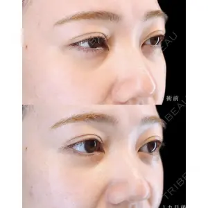 HAAB BEAUTY CLINIC 南青山本院（新院）の症例