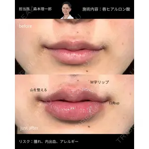 PRISM Beauty Clinic 町田院の症例