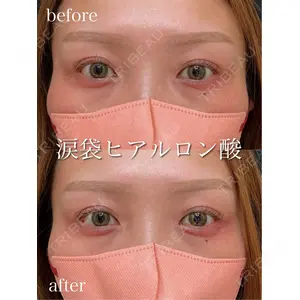 アデル美容クリニックの症例