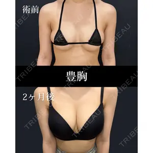 HAAB×DREAM BEAUTY CLINIC 東京本院 齋藤 丈瑠医師の症例
