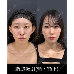 HAAB×DREAM BEAUTY CLINIC 東京本院 齋藤 丈瑠医師の症例
