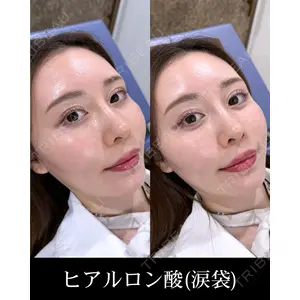 HAAB×DREAM BEAUTY CLINIC 東京本院 西川　真由医師の症例