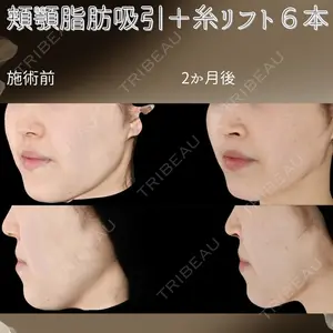下北沢スキンクリニックの症例