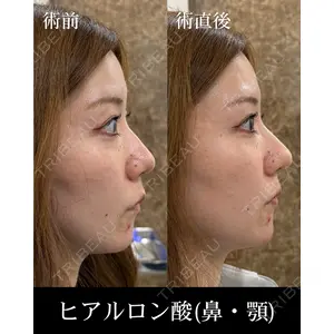 HAAB×DREAM BEAUTY CLINIC 東京本院 西川　真由医師の症例
