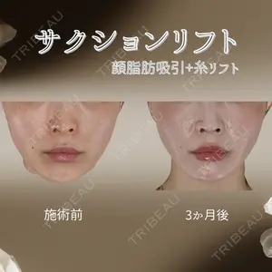 下北沢スキンクリニックの症例