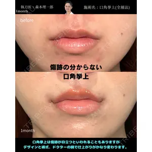 PRISM Beauty Clinic 町田院 森本 理一郎医師の症例