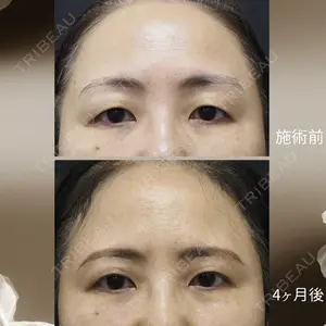 下北沢スキンクリニックの症例