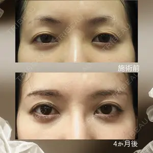 下北沢スキンクリニックの症例