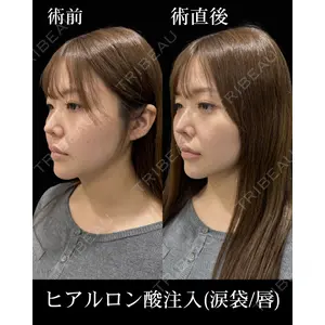 HAAB BEAUTY CLINIC 名古屋院 柳 立樹医師の症例