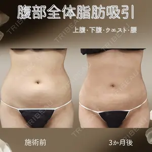 下北沢スキンクリニックの症例