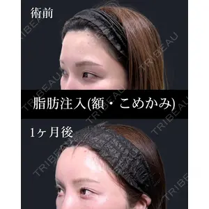 HAAB×DREAM BEAUTY CLINIC 東京本院 西川　真由医師の症例