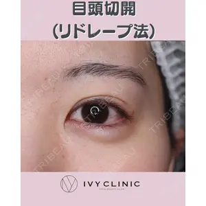 千葉美容外科アイビークリニックの症例