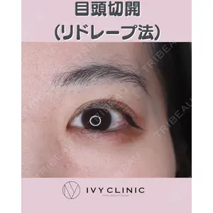千葉美容外科アイビークリニックの症例