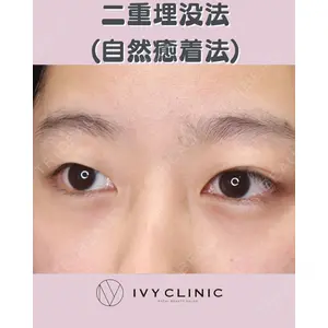 千葉美容外科アイビークリニックの症例