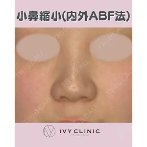 千葉美容外科アイビークリニックの症例